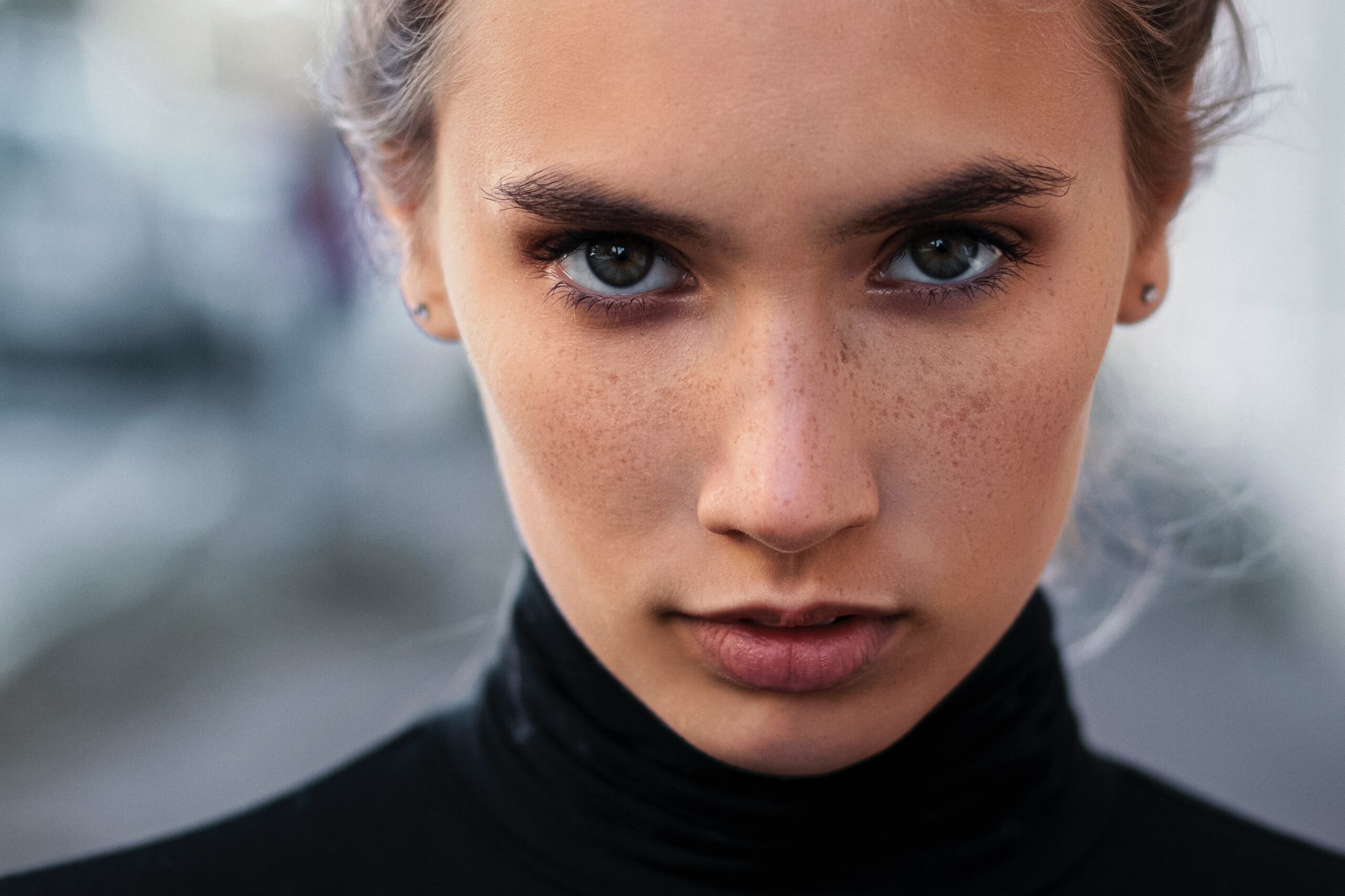 Blackhead Removal