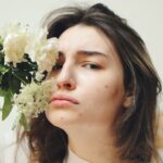 how to remove pimple marks