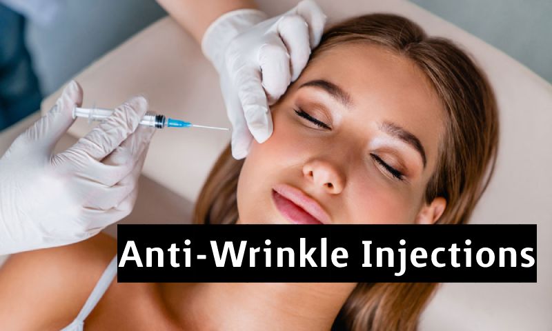 Facts You Need to Know About Anti-Wrinkle Injections