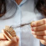 WHY AM I Suddenly Losing My Hair?