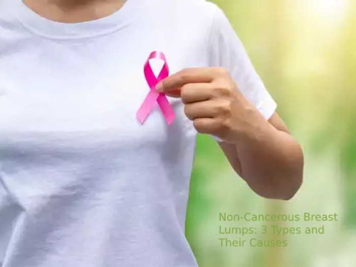 Non-Cancerous Breast Lumps: 3 Types and Their Causes