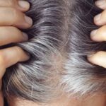 Stress Can Result In Early Grey Hair.