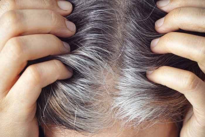 Stress Can Result In Early Grey Hair.