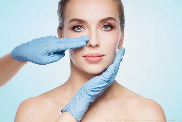 DO YOU CONSIDER RHINOPLASTY REVISION? A FEW THINGS YOU NEED TO KNOW