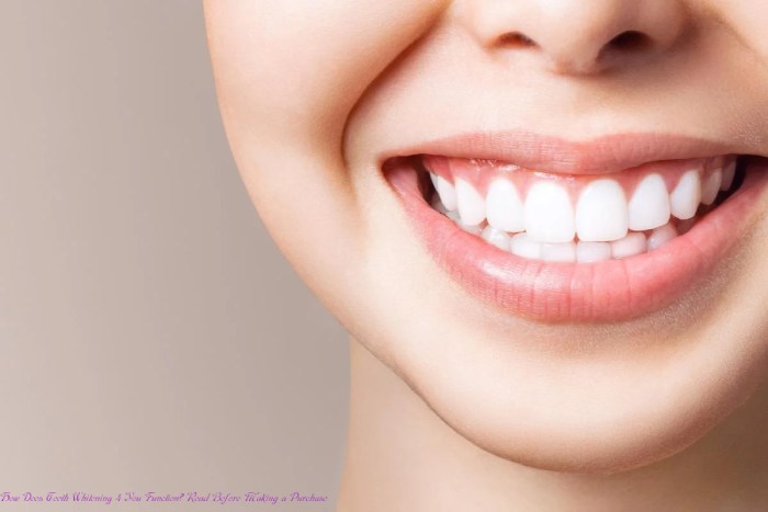 How Does Teeth Whitening 4 You Function? Read Before Making a Purchase